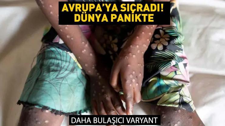 Avrupa’ya da sıçradı! Afrika dışındaki ilk vaka görüldü! İsveç’te daha bulaşıcı varyant ortaya çıktı!