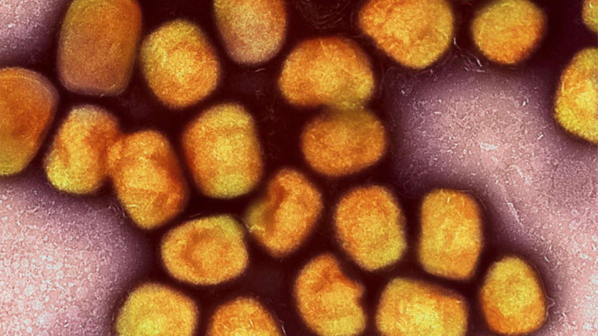 Bir ülkede daha mpox tespit edildi: Hasta BAE’den gitmiş