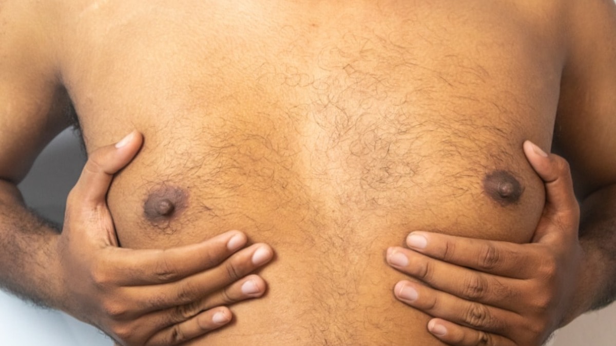 Jinekomasti nedir? Erkeklerde göğüs büyümesinin nedenleri nelerdir?