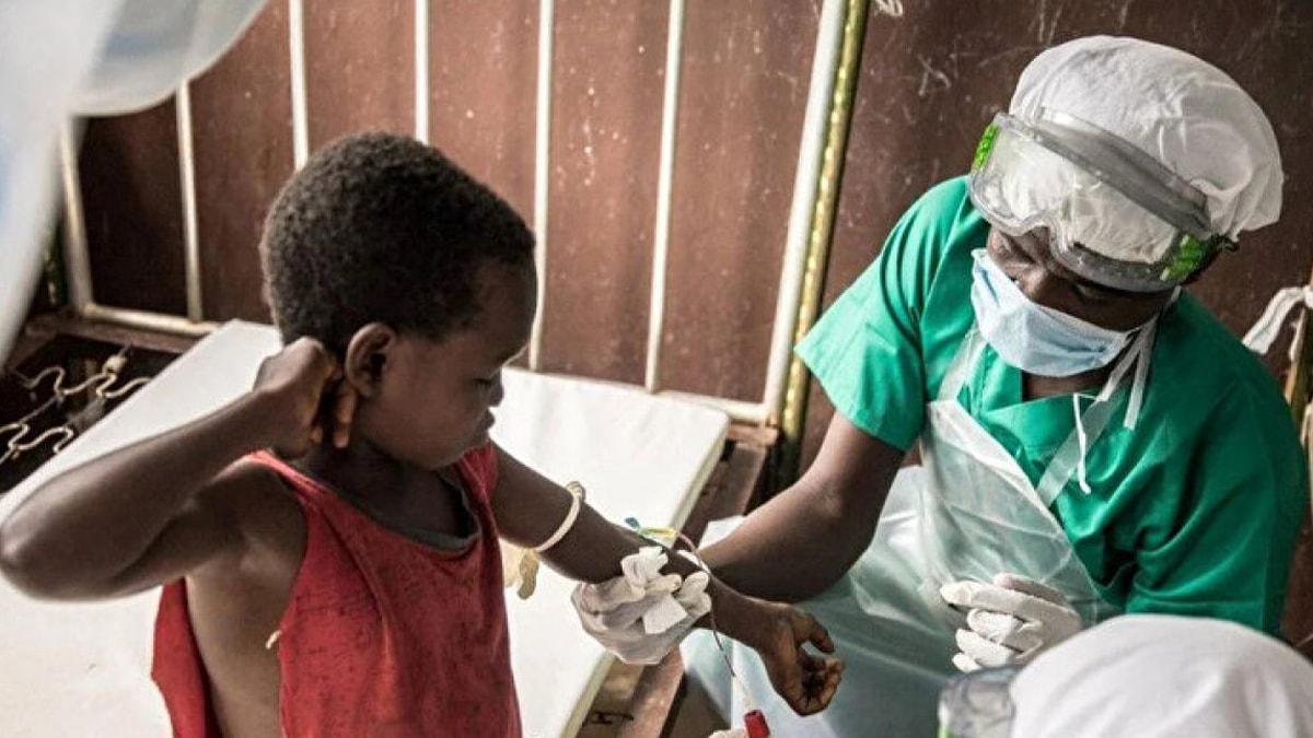 Maymun Çiçeği Virüsü Afrika’yı sardı; korkulan boyutlara ulaşıyor! Maymun Çiçeği Virüsü nedir, belirtileri nelerdir, bulaşıcı mı?