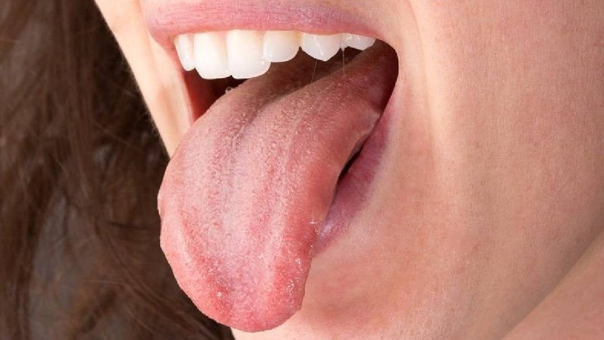 Dildeki bu işaret büyük tehlikenin habercisi