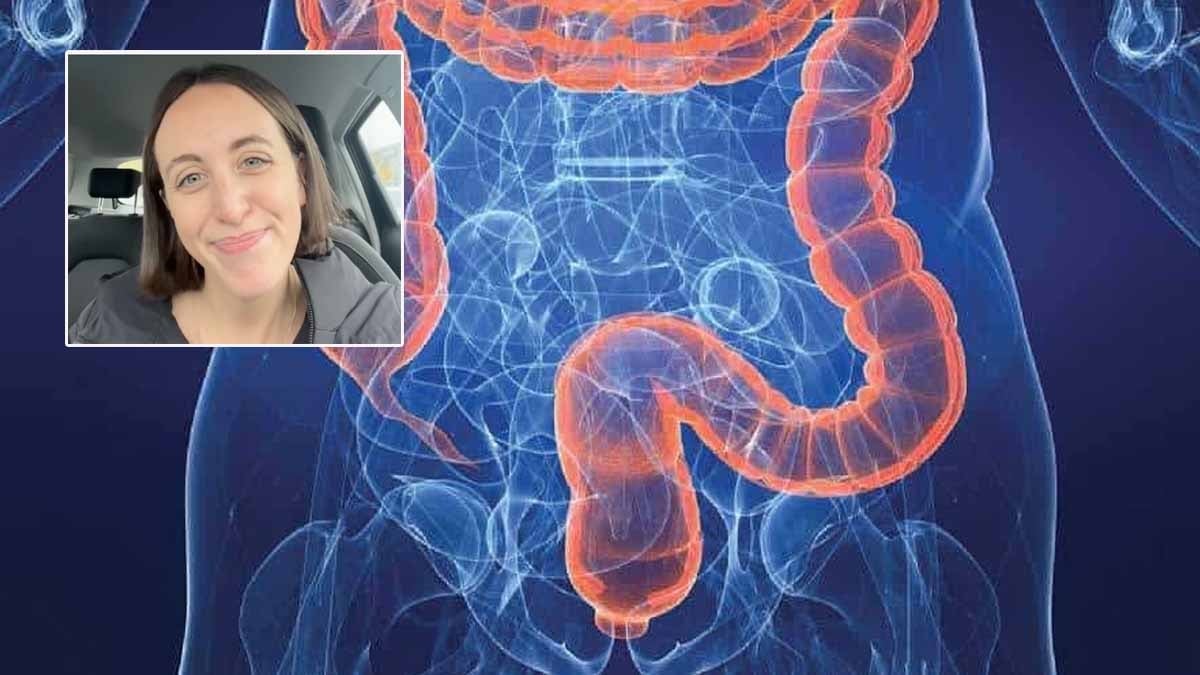 Henüz 25 yaşında kolon kanserine yakalandı, ‘bana olmaz demeyin’ diyerek kendisinde gördüğü 4 belirtiyi sıraladı