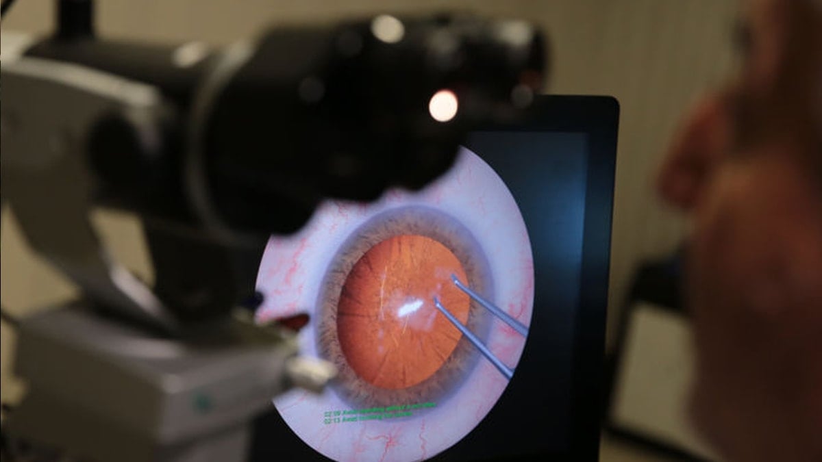 Türk göz hekimleri canlı cerrahi sempozyumunda buluştu